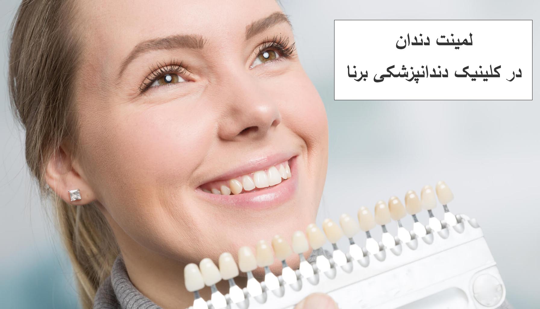 لمینت دندان قسطی در کلینیک دندانپزشکی برنا تهران