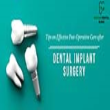 Post-dental implant care