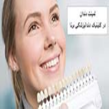 لمینت دندان قسطی در کلینیک دندانپزشکی برنا تهران