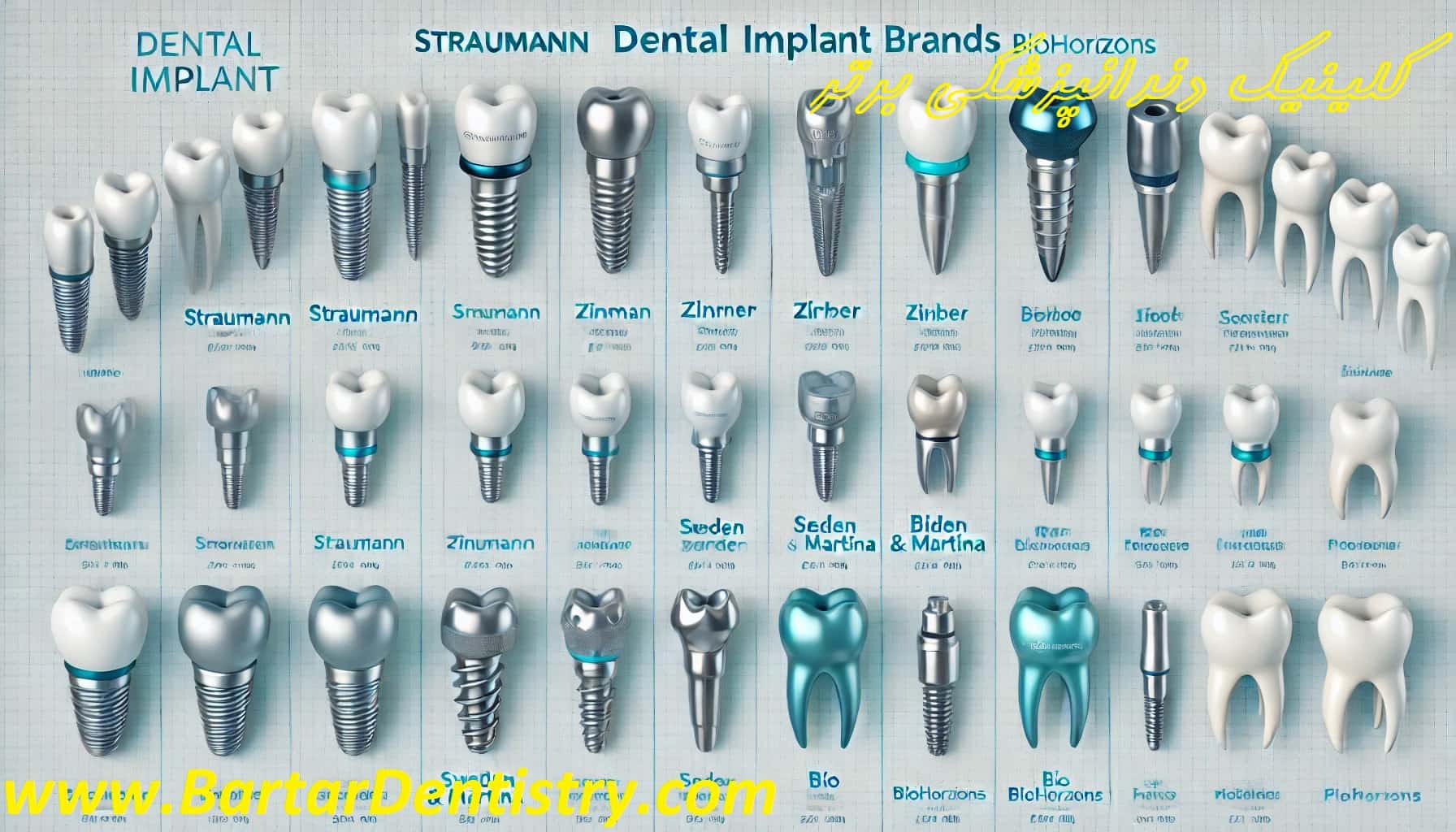 انواع برندهای ایمپلنت دندانimplant